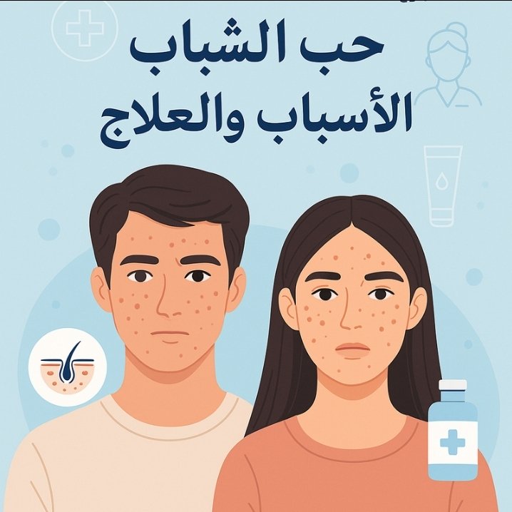 حب الشباب: الأسباب والعلاج