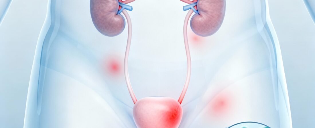 عدوى أو التهابات المسالك البولية | Urinary tract infections (UTIs)