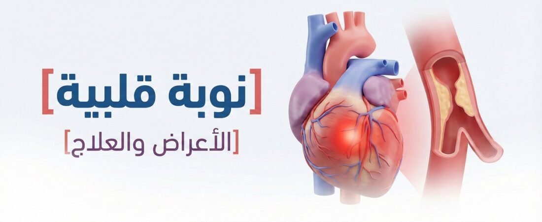 النوبة القلبية | Heart attack