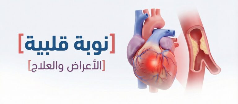 النوبة القلبية