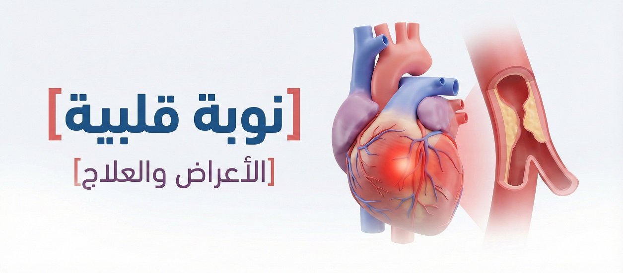 النوبة القلبية | Heart attack