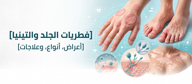فطريات الجلد أو التينيا أو السعفة |  Ringworm or Tinea