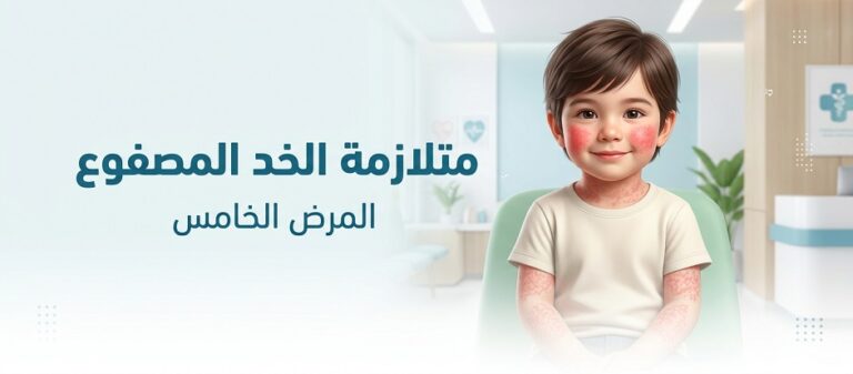 متلازمة الخد المصفوع