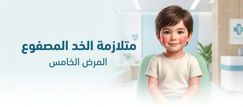متلازمة الخد المصفوع | Slapped cheek syndrome