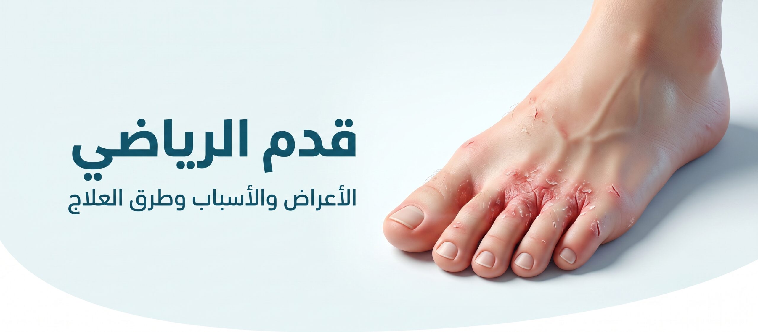 قدم الرياضي | Athlete’s foot
