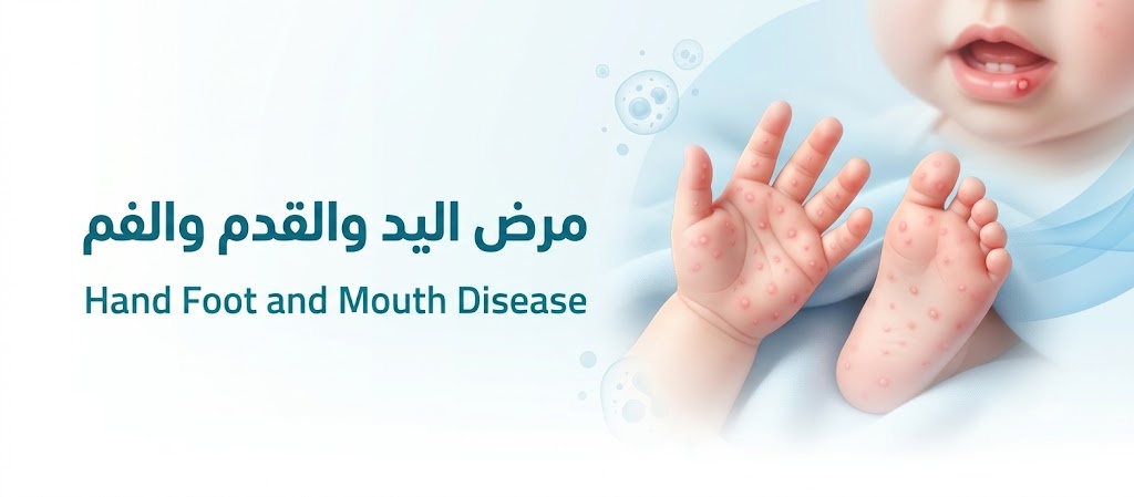 مرض اليد والقدم والفم | Hand, foot and mouth disease